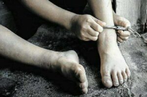 Shackled Foot Child found on beach in St Lucia with shackles on her feet - Jamaica ...