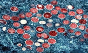 Thailand reports suspected case of new mpox strain - Jamaica Observer