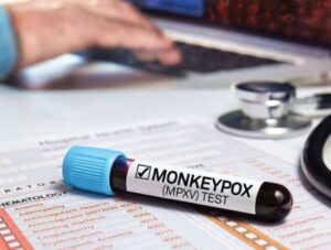 Corporate Area records first case of monkeypox - Jamaica Observer