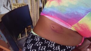 Woman injured in Westmoreland shooting says she won't attend any more parties - Vimarsana News