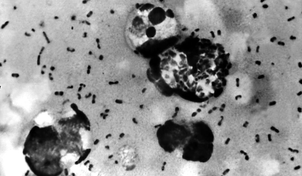 Russian officials say ‘situation under control’ after plague reports