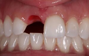 Lawyer accused of knocking out woman’s tooth to return to court April ...