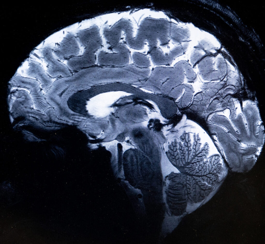 Mri Examn World's most powerful MRI scans first images of human brain - Jamaica ...