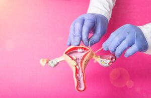 Trends in female sterilisation - Jamaica Observer - Vimarsana News