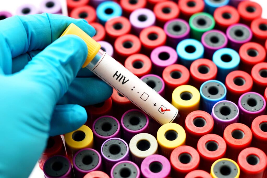 PAHO provides new opportunity for Latin America and the Caribbean to access HIV drugs