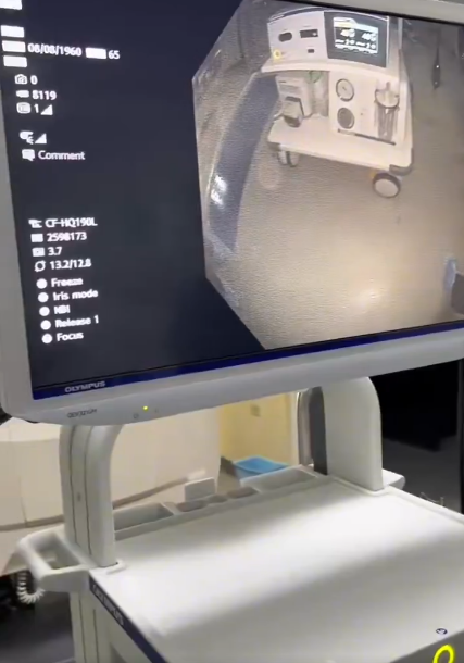 Mandeville Regional Hospital performs first colonoscopy, expands cancer screening access