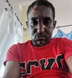 Spanish Town Hospital rejects negligence claim over crash victim’s 10-month surgery wait