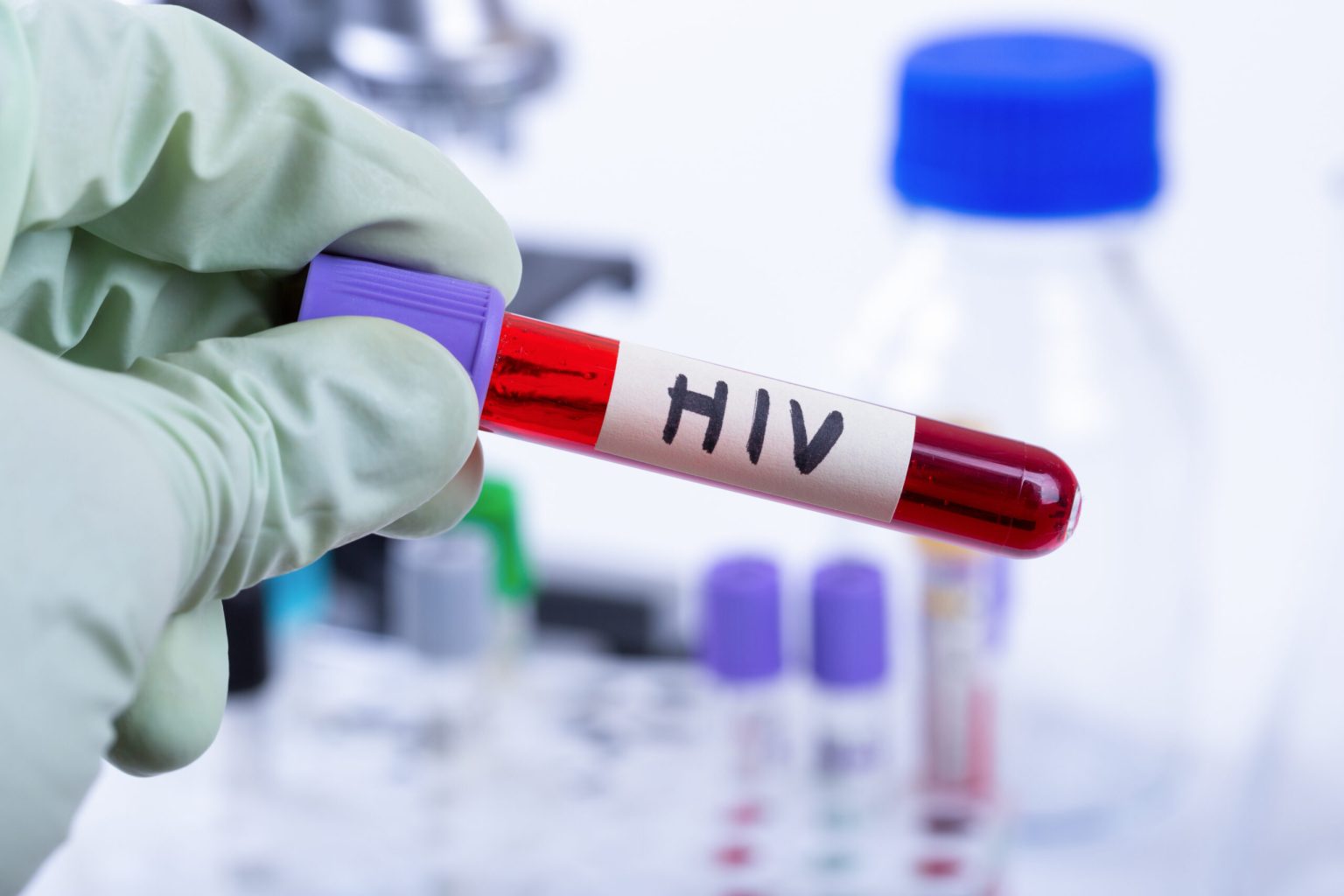 No symptoms, no warning: The STI you discover too late - Jamaica Observer